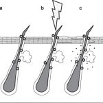 Adapalen làm tăng sự xâm nhập của Clindamycin vào nang lông khi điều trị đồng thời.